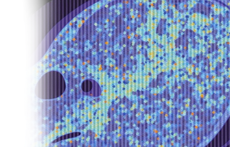 КТ мягких тканей шеи с фонацией