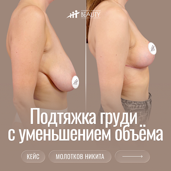 Примеры работ пластического хирурга Молоткова Н.С.