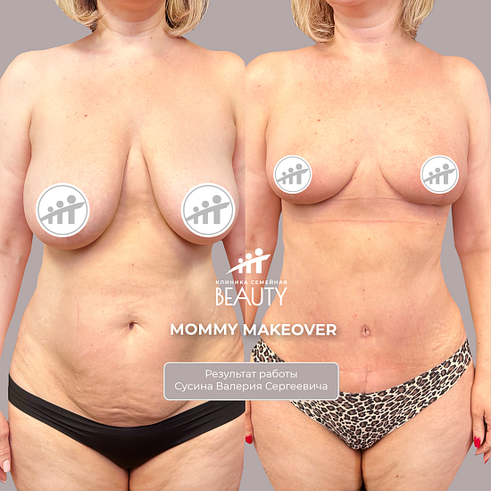 Примеры работ пластического хирурга Сусина В.С.