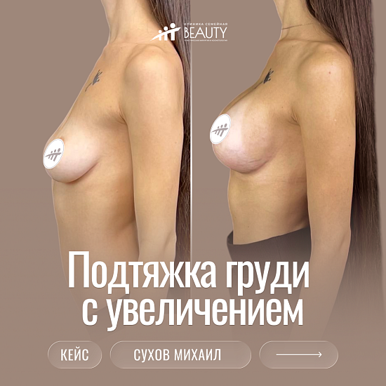 Примеры работ пластического хирурга Сухова М.Н.