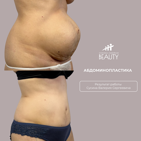 Примеры работ пластического хирурга Сусина В.С.