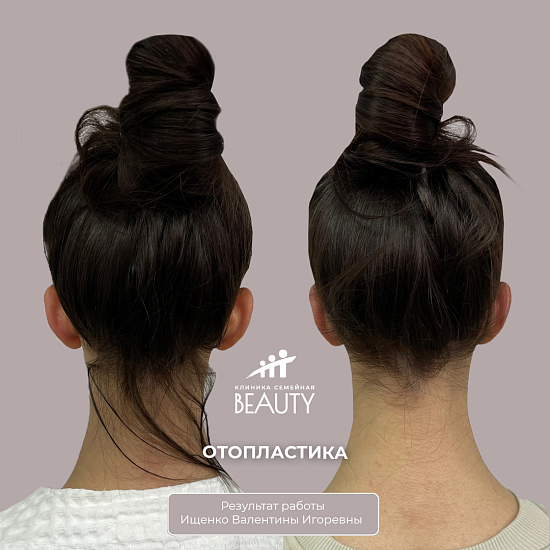 Примеры работ пластического хирурга Ищенко В.И.