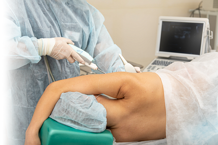 Вакуумная аспирационная биопсия