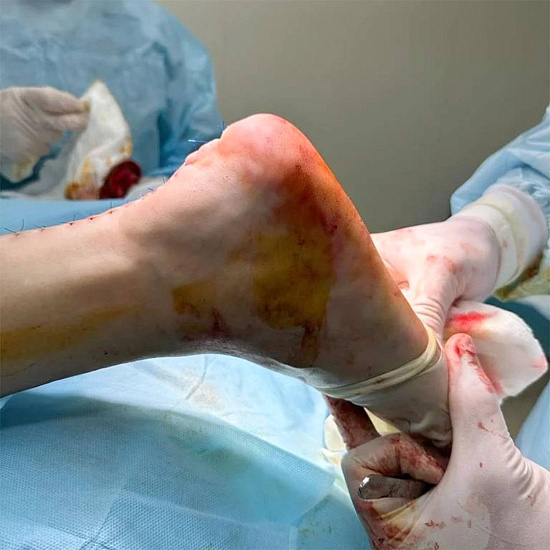 Неправильная обувь