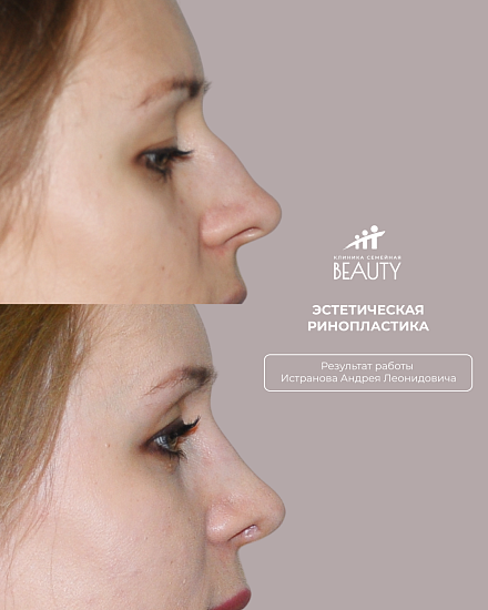 Примеры работ пластического хирурга Истранова А.Л.
