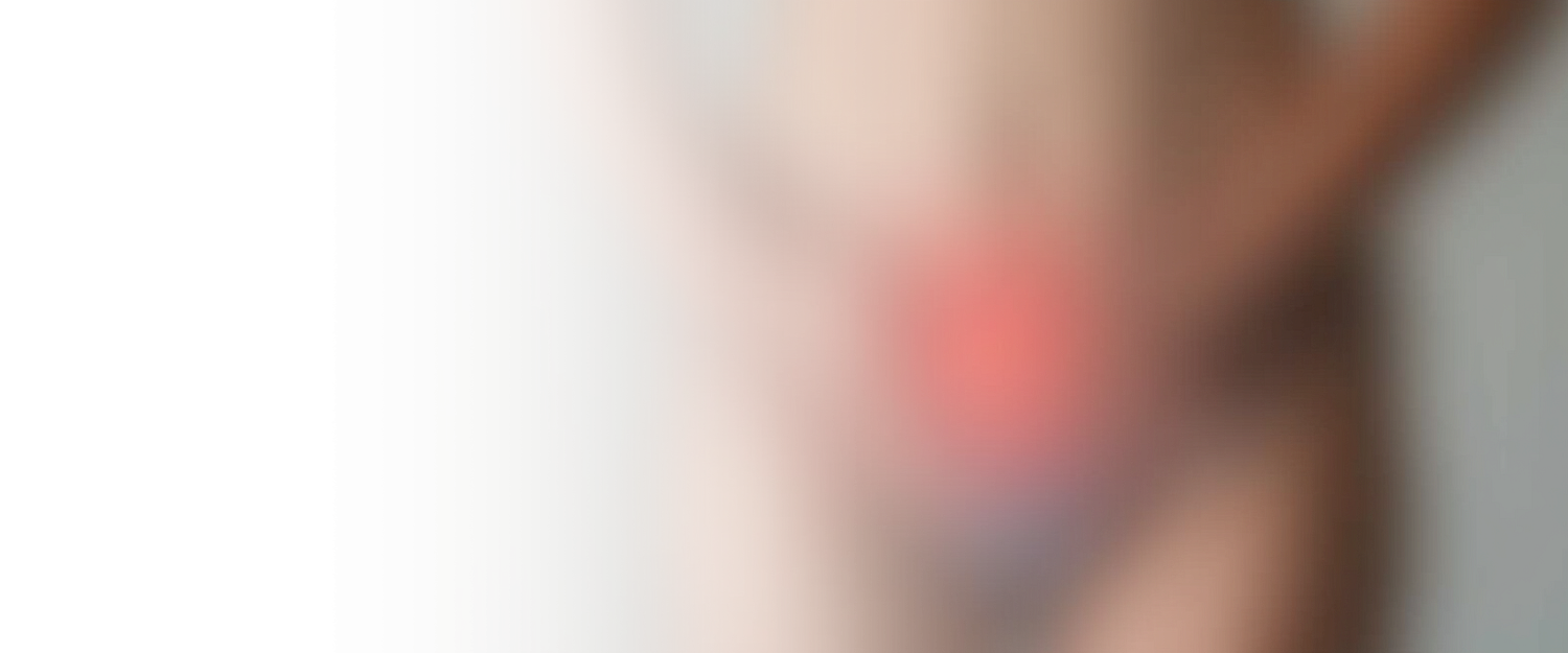 Вскрытие абсцесса бартолиновой железы