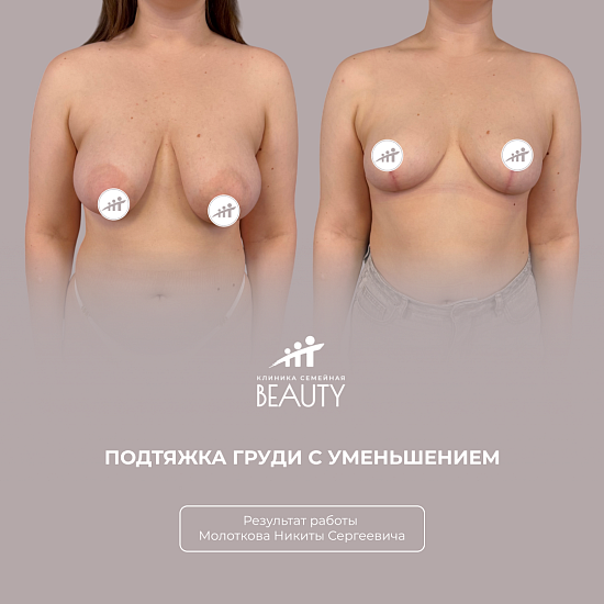 Примеры работ пластического хирурга Молоткова Н.С.