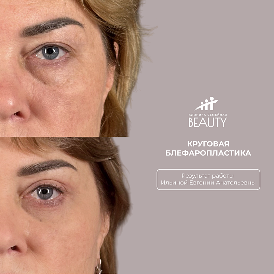 Примеры работ пластического хирурга Ильиной Евгении Анатольевны