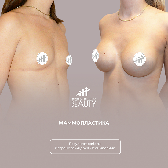 Примеры работ пластического хирурга Истранова А.Л.