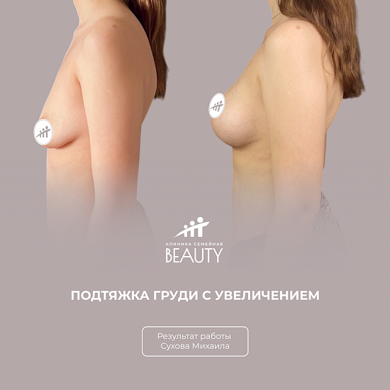 Примеры работ пластического хирурга Сухова М.Н.