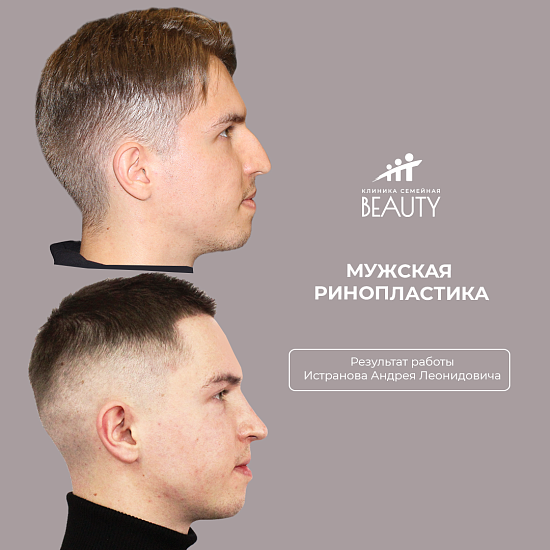 Примеры работ пластического хирурга Истранова А.Л.