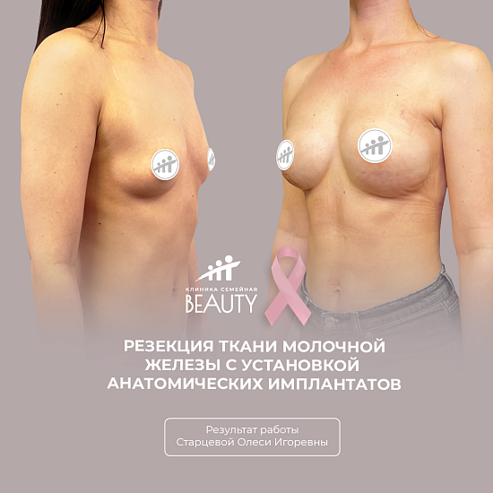 Примеры работ пластического хирурга Старцевой О.И.