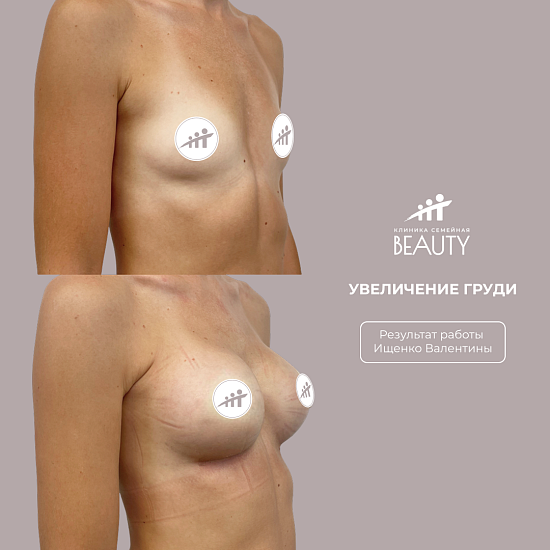 Примеры работ пластического хирурга Ищенко В.И.