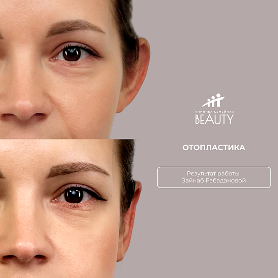Примеры работ пластического хирурга Рабадановой З.М.