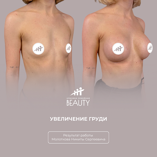 Примеры работ пластического хирурга Молоткова Н.С.