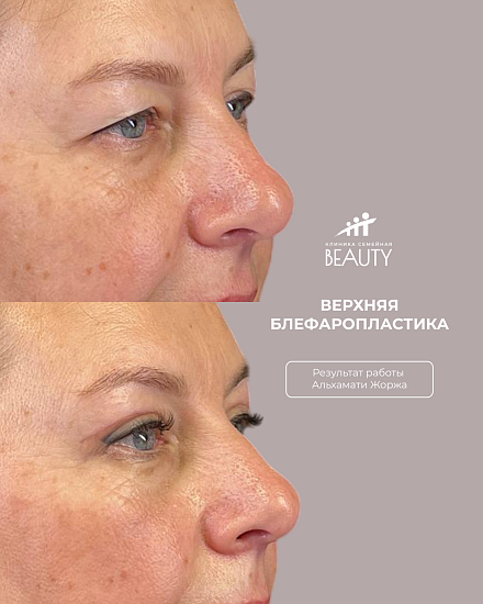 Примеры работ пластического хирурга Альхамати Ж.В.