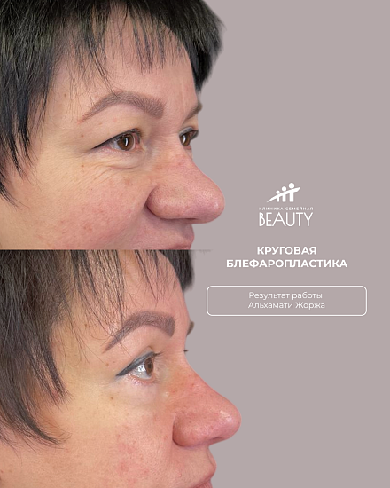 Примеры работ пластического хирурга Альхамати Ж.В.