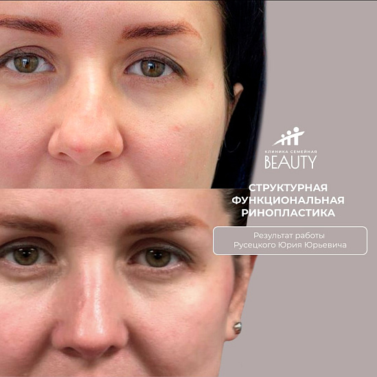 Примеры работ пластического хирурга Русецкого Ю.Ю.